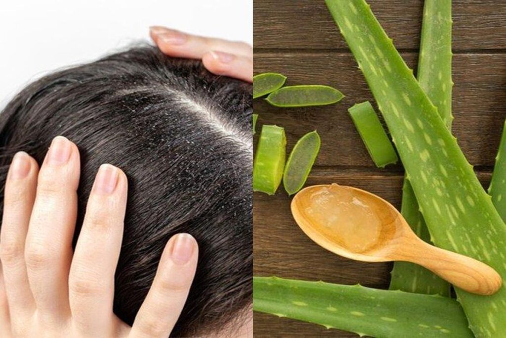 Manfaat Lidah Buaya Untuk Rambut